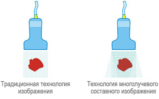 Традиционная технология изображения и Технология многолучевого составного изображения Традиционная технология изображения и Технология многолучевого составного изображения