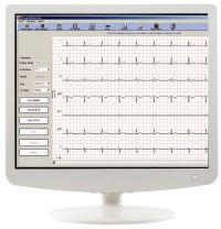 Компьютерный ветеринарный электрокардиограф Cardiomaq PC V (Австрия)
